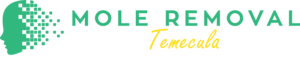 mole removal temecula logo