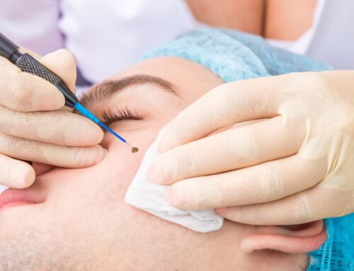 Mole Removal Lake Elsinore, CA