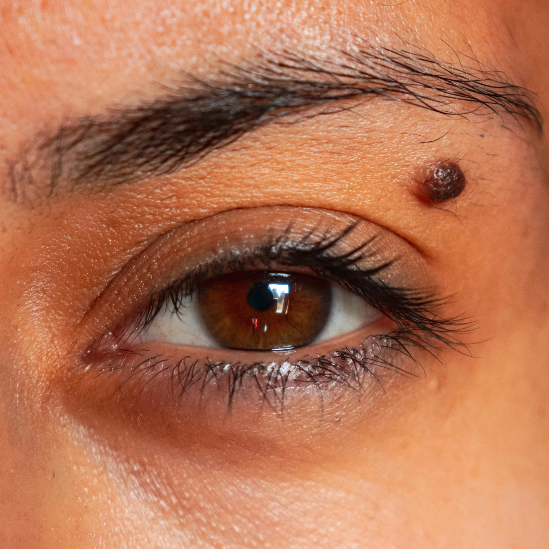 affordable mole removal Jurupa Valley california