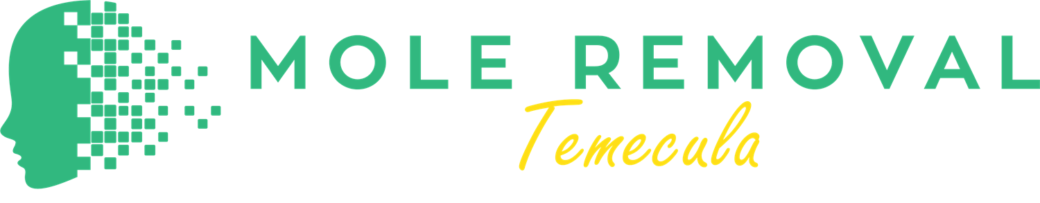 Mole Removal Temecula Logo